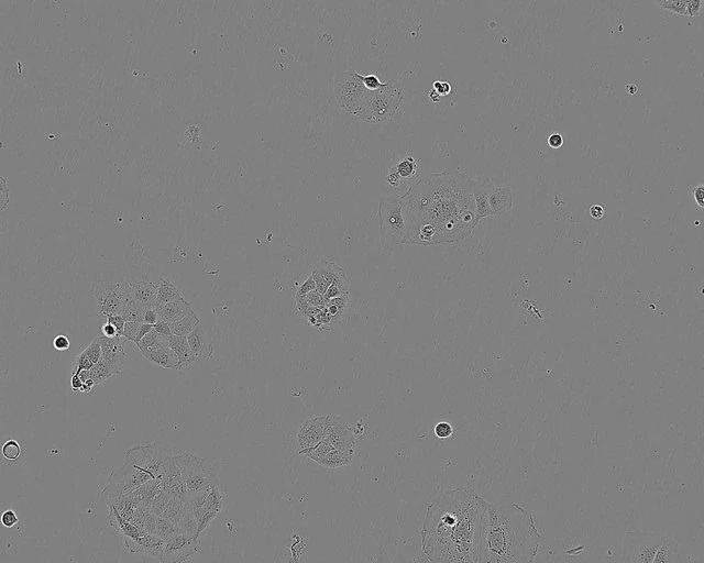 Sulfur PESTANAL®, analytical standardCACO-2 CELL LINE HUMAN FROM HUMAN COLON(CAUCADENOCARCINOMA) 1 VIAL