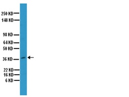 [AB1870] SIGMA-ALDRICH ANTICUERPO ANTI-OSTEOPONTINA, POLICLONAL, SUERO DE CONEJO, VALIDADO PARA USO EN ELISA, IH, IH(P), WB - 100µL