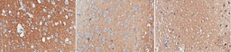 [MABN894] SIGMA-ALDRICH ANTICUERPO ANTI-SINAPSINA-1, CLON 10.22, SINAPSINA-1 PURIFICADA DE CEREBRO BOVINO, VALIDADO PARA WB, IH(P), IP, IF - 100µG